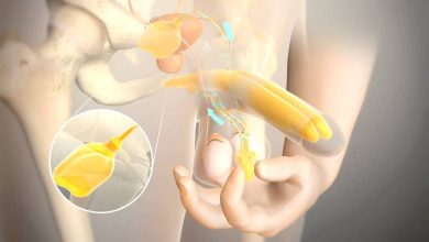 Протезирование полового члена, фаллопротезирование: что это за операция, причины, противопоказания, как выполняют